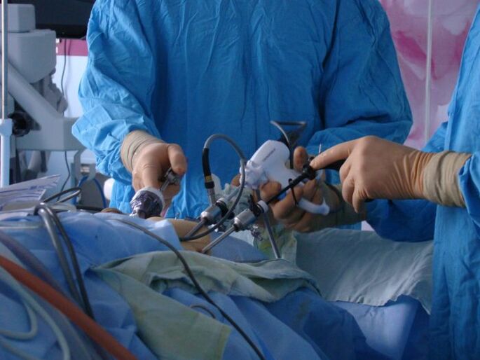 trattamento chirurgico della prostatite