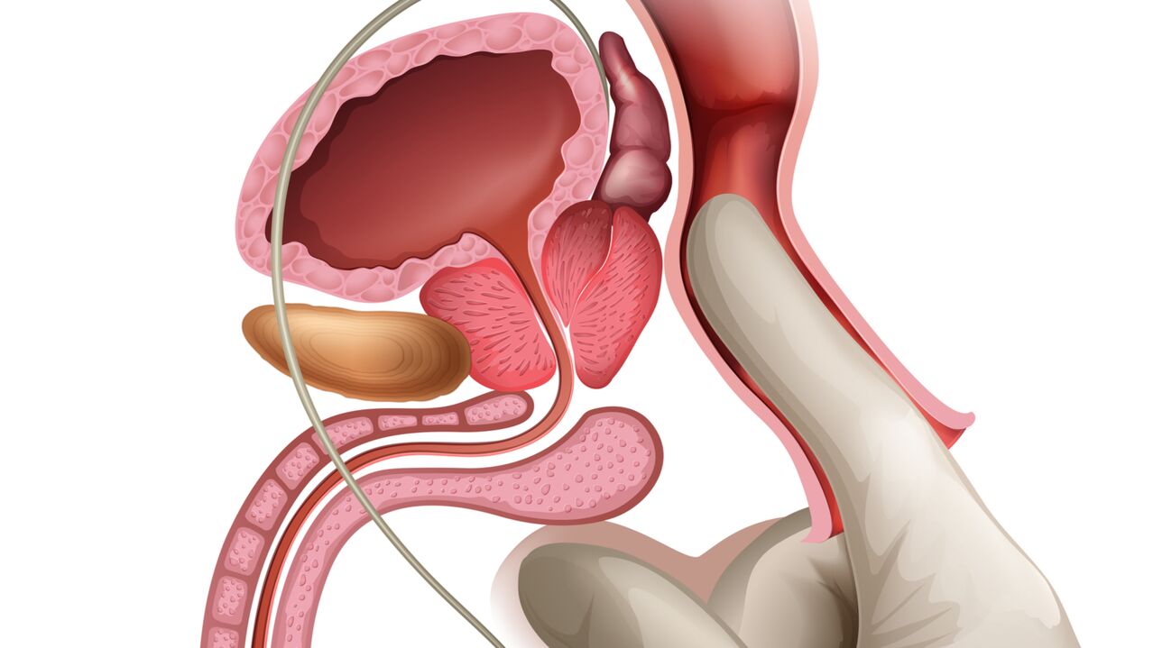Il massaggio prostatico è un modo efficace per trattare la prostatite congestizia