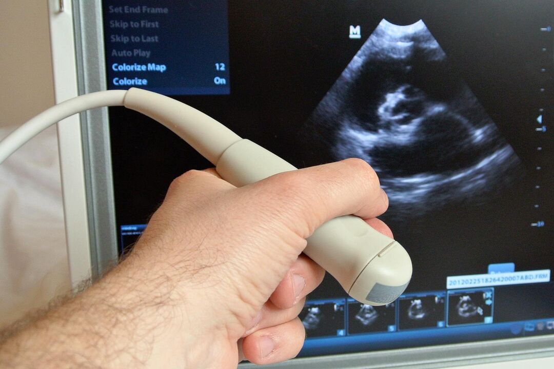 L'ecografia aiuterà a diagnosticare la prostatite congestizia in un uomo
